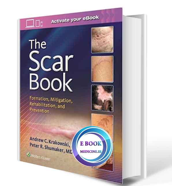 دانلود کتاب The Scar Book: Formation, Mitigation, Rehabilitation and Prevention2017 (   PDF)  